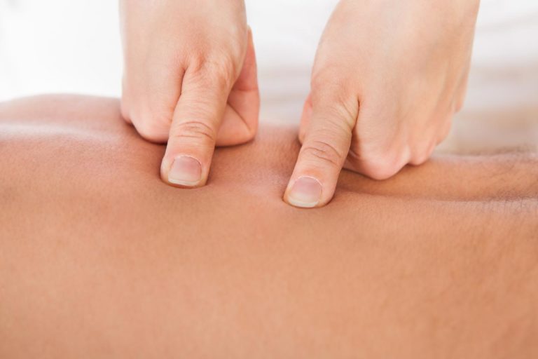 physio_triggerpoint